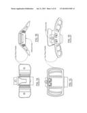 Orthopedic Brace with Sloping Paddle Members diagram and image