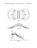 Orthopedic Brace with Sloping Paddle Members diagram and image