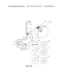 GASTROINTESTINAL PROSTHESES diagram and image