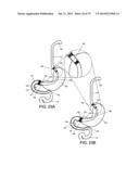 GASTROINTESTINAL PROSTHESES diagram and image