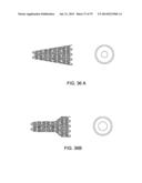 GASTROINTESTINAL PROSTHESES diagram and image