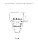 GASTROINTESTINAL PROSTHESES diagram and image