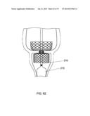 GASTROINTESTINAL PROSTHESES diagram and image