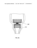 GASTROINTESTINAL PROSTHESES diagram and image