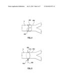 NERVE IMPINGEMENT SYSTEMS INCLUDING AN INTRAVASCULAR PROSTHESIS AND AN     EXTRAVASCULAR PROSTHESIS AND ASSOCIATED SYSTEMS AND METHODS diagram and image