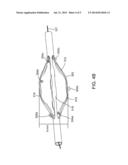 METHOD AND SYSTEM FOR TISSUE MODULATION diagram and image