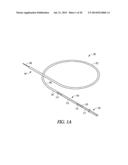 CATHETER WITH A DEPLOYABLE SCRUBBING ASSEMBLY diagram and image