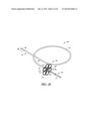 CATHETER WITH A DEPLOYABLE SCRUBBING ASSEMBLY diagram and image