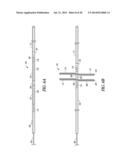 CATHETER WITH A DEPLOYABLE SCRUBBING ASSEMBLY diagram and image