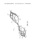 CATHETER WITH A DEPLOYABLE SCRUBBING ASSEMBLY diagram and image