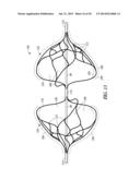 CATHETER WITH A DEPLOYABLE SCRUBBING ASSEMBLY diagram and image