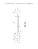 PERCUTANEOUS THROMBUS EXTRACTION DEVICE diagram and image