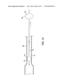 PERCUTANEOUS THROMBUS EXTRACTION DEVICE diagram and image