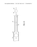 PERCUTANEOUS THROMBUS EXTRACTION DEVICE diagram and image