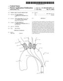 AORTIC GREAT VESSEL PROTECTION diagram and image