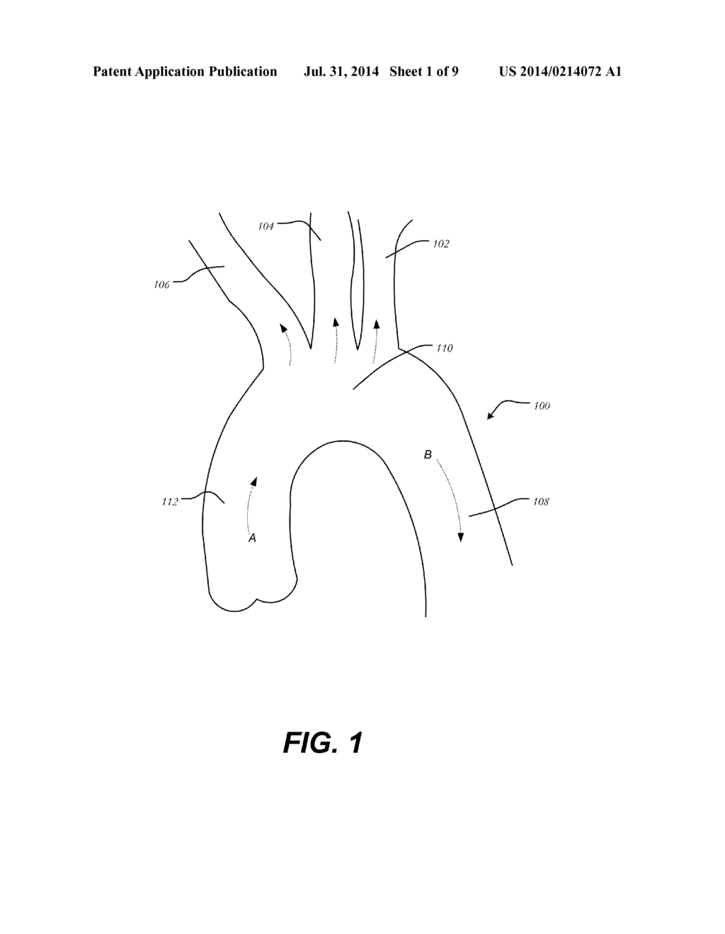 AORTIC GREAT VESSEL PROTECTION - diagram, schematic, and image 02