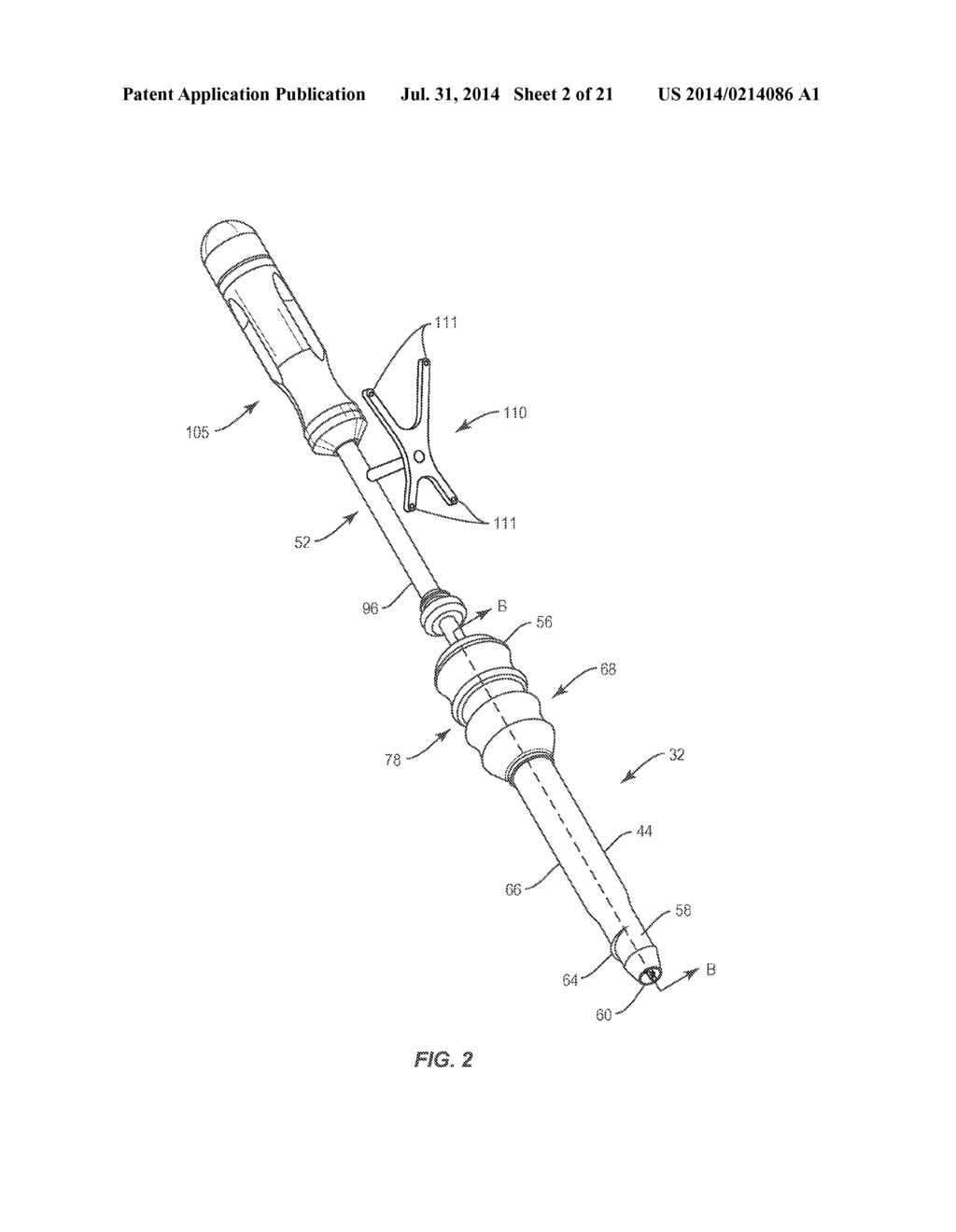 SURGICAL IMPLANT SYSTEM AND METHOD - diagram, schematic, and image 03