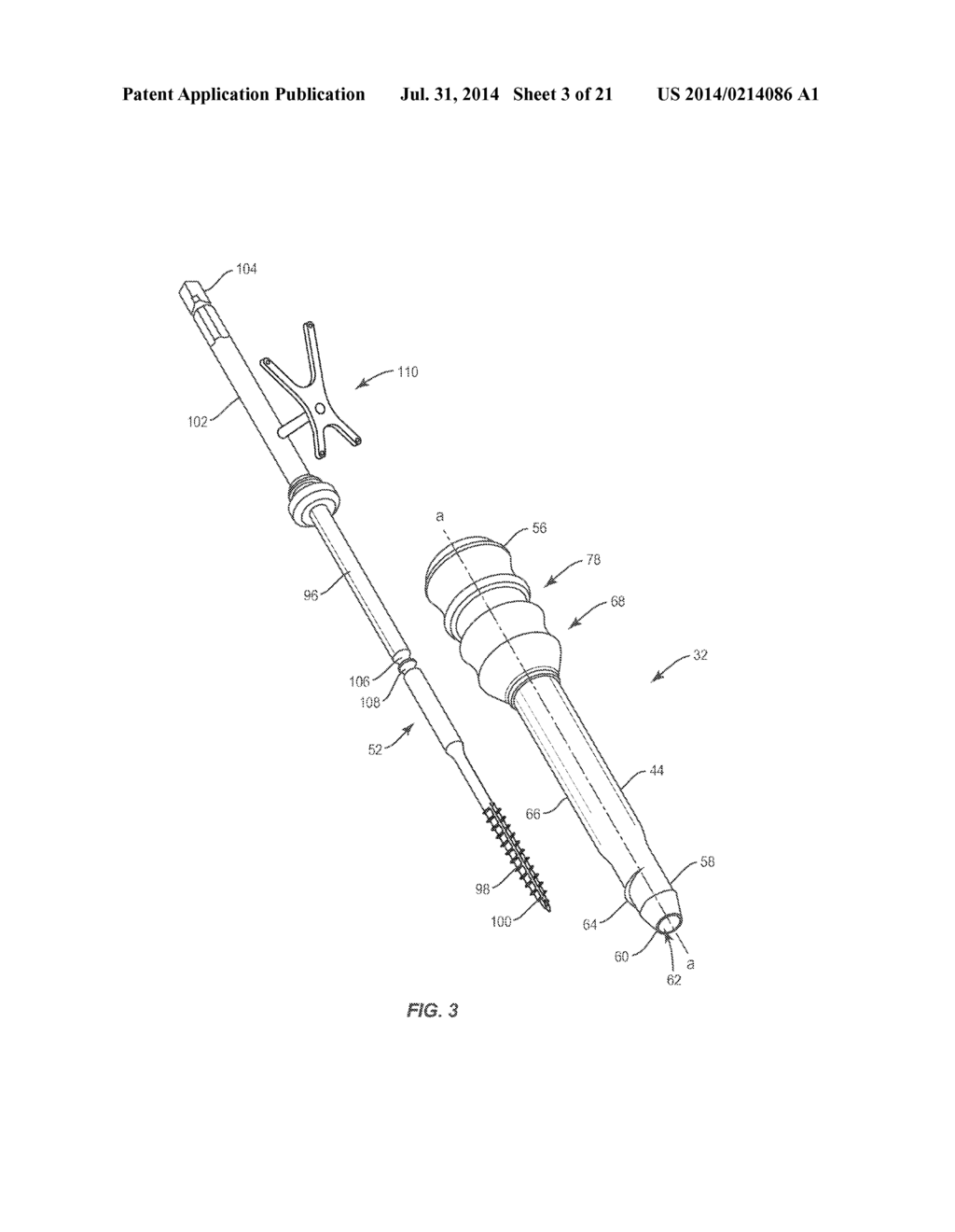 SURGICAL IMPLANT SYSTEM AND METHOD - diagram, schematic, and image 04