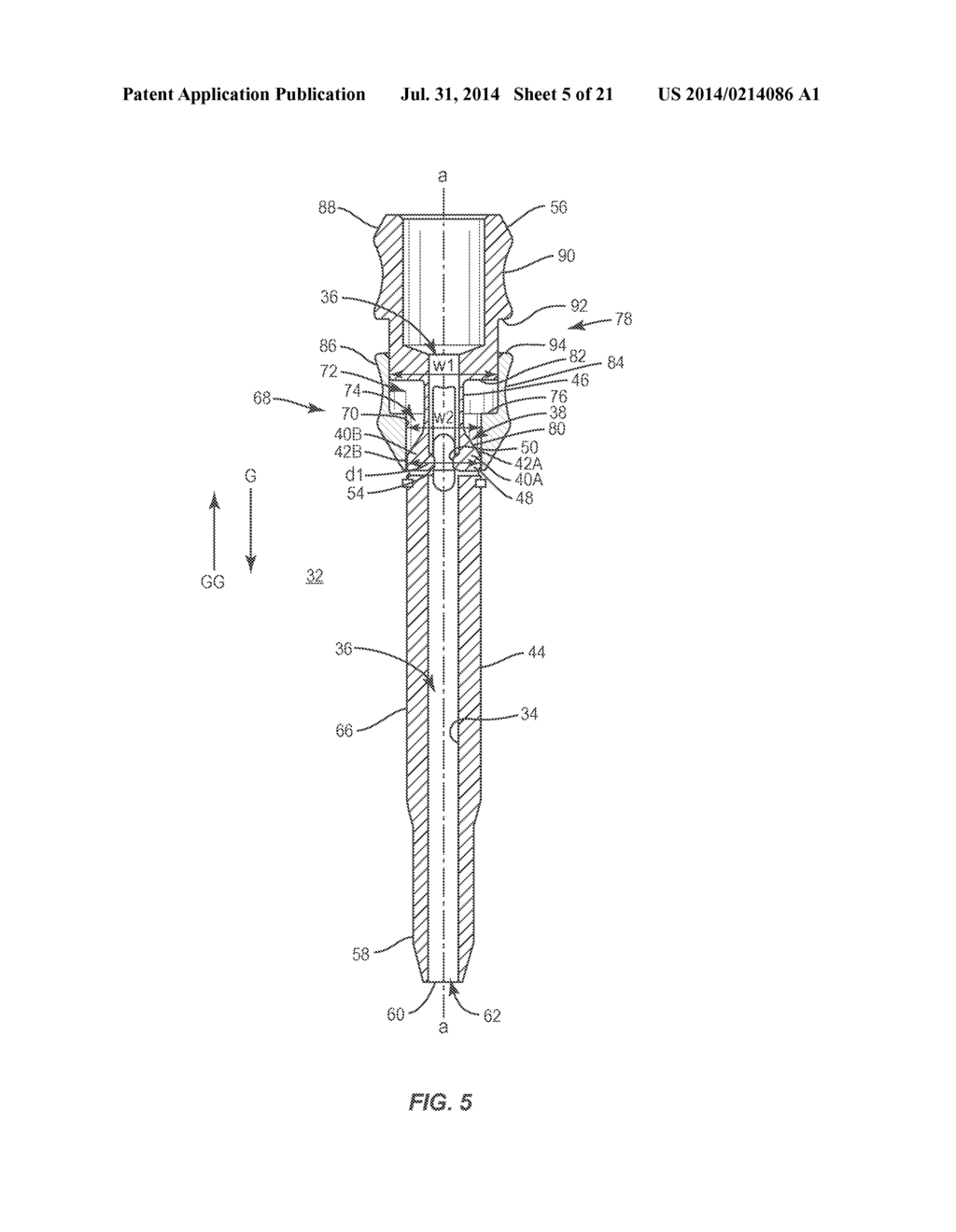 SURGICAL IMPLANT SYSTEM AND METHOD - diagram, schematic, and image 06