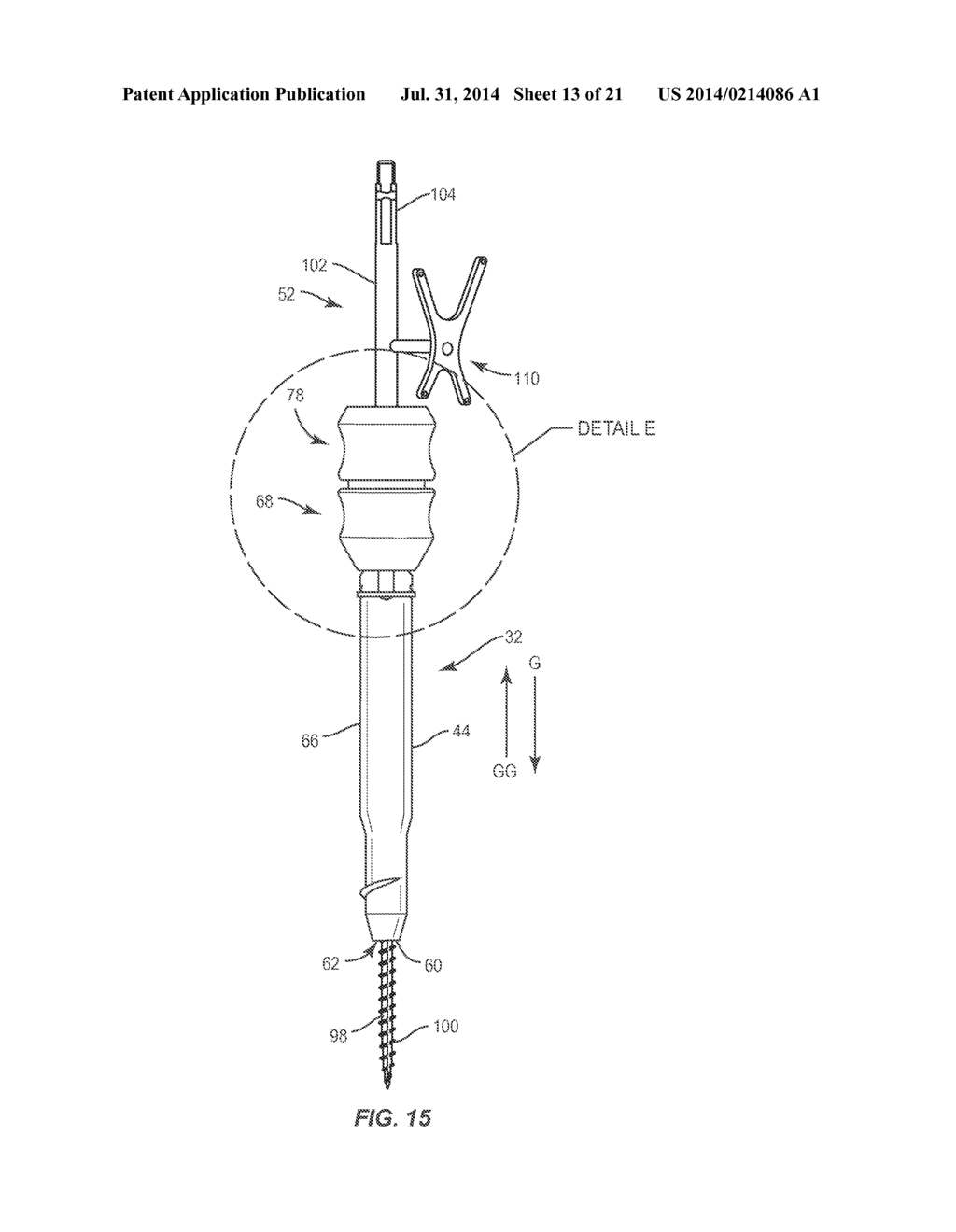 SURGICAL IMPLANT SYSTEM AND METHOD - diagram, schematic, and image 14