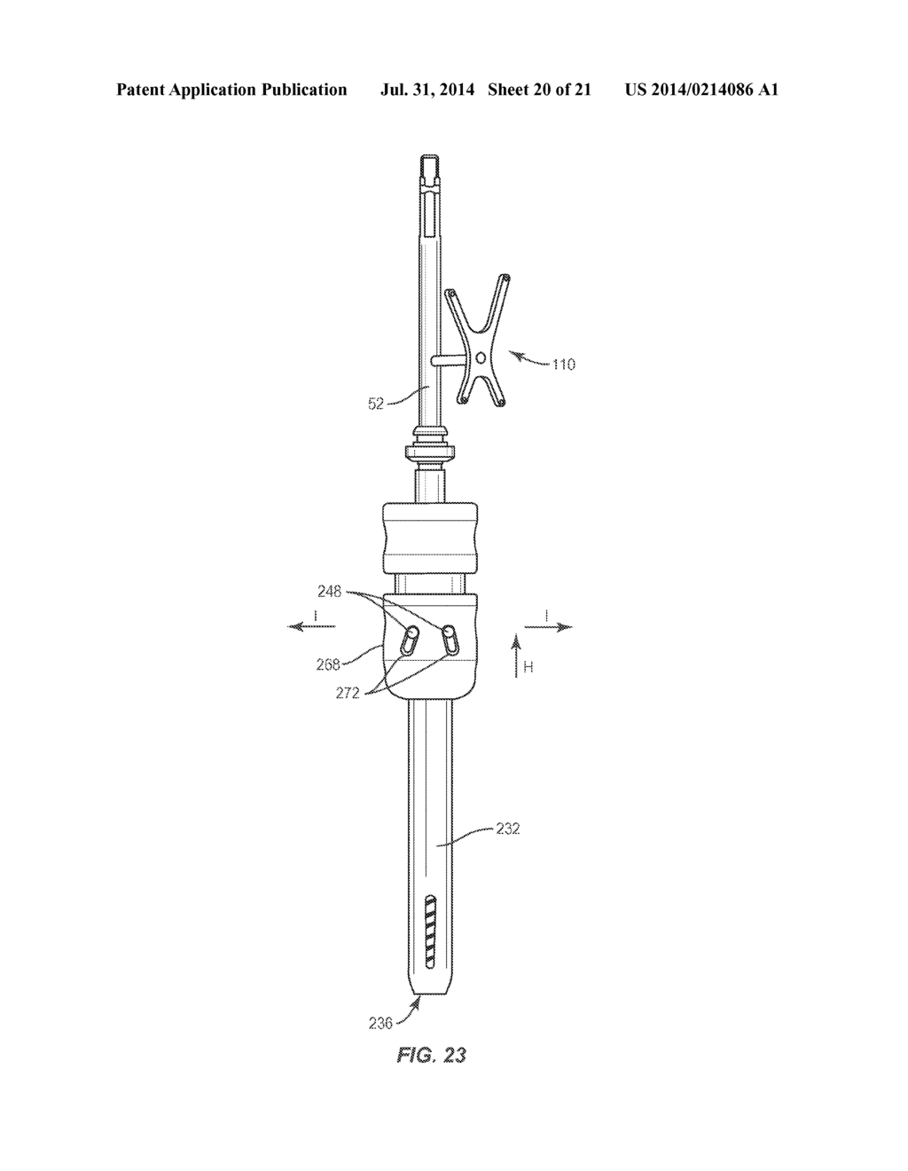 SURGICAL IMPLANT SYSTEM AND METHOD - diagram, schematic, and image 21