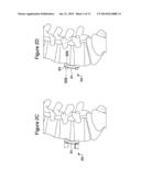 ORTHOPAEDIC PLATE diagram and image