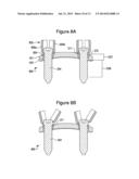 ORTHOPAEDIC PLATE diagram and image