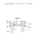 ORTHOPAEDIC PLATE diagram and image