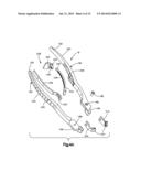 BONE FIXATION SYSTEMS AND METHODS OF USE diagram and image