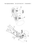 BONE FIXATION SYSTEMS AND METHODS OF USE diagram and image