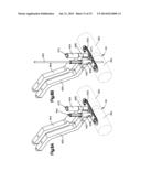 BONE FIXATION SYSTEMS AND METHODS OF USE diagram and image