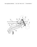 BONE FIXATION SYSTEMS AND METHODS OF USE diagram and image