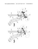 BONE FIXATION SYSTEMS AND METHODS OF USE diagram and image