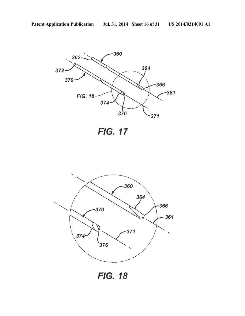 Disposable Orthopedic Surgery Kit And Components - diagram, schematic, and image 17