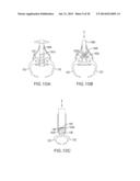 SYSTEMS AND DEVICES FOR THE REDUCTION AND ASSOCIATION OF BONES diagram and image