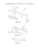 SYSTEMS AND DEVICES FOR THE REDUCTION AND ASSOCIATION OF BONES diagram and image