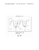 SYSTEMS AND METHODS TO MONITOR AND TREAT HEART FAILURE CONDITIONS diagram and image