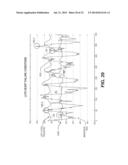 SYSTEMS AND METHODS TO MONITOR AND TREAT HEART FAILURE CONDITIONS diagram and image