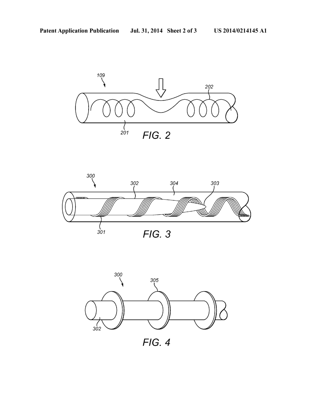 Impact Protection for Implantable Electric Lead - diagram, schematic, and image 03