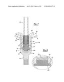 Transdermal Intraosseous Device diagram and image