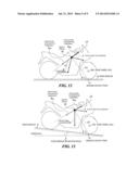 BAR-HANDLE VEHICLE BRAKE CONTROL APPARATUS diagram and image