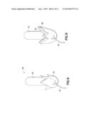 Tampon Pledget With Improved By-pass Leakage Protection diagram and image