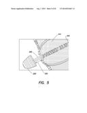 FUNDUS BUMPER MECHANICAL REFERENCE FOR EASIER MECHANISM DEPLOYMENT diagram and image