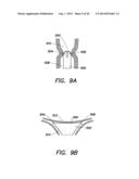 FUNDUS BUMPER MECHANICAL REFERENCE FOR EASIER MECHANISM DEPLOYMENT diagram and image