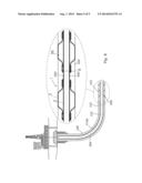 ANNULAR BARRIER WITH PRESSURE AMPLIFICATION diagram and image