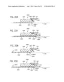 DEPLOYING AN EXPANDABLE DOWNHOLE SEAT ASSEMBLY diagram and image