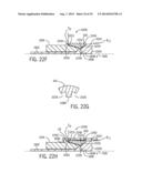 DEPLOYING AN EXPANDABLE DOWNHOLE SEAT ASSEMBLY diagram and image