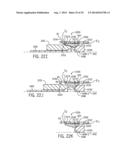 DEPLOYING AN EXPANDABLE DOWNHOLE SEAT ASSEMBLY diagram and image