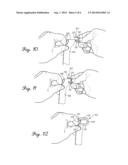 LOOP CLIPS FOR GOLF BAGS AND METHODS TO MANUFACTURE GOLF BAGS diagram and image