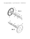 Ratcheting Mechanism for Surgical Stapling Device diagram and image